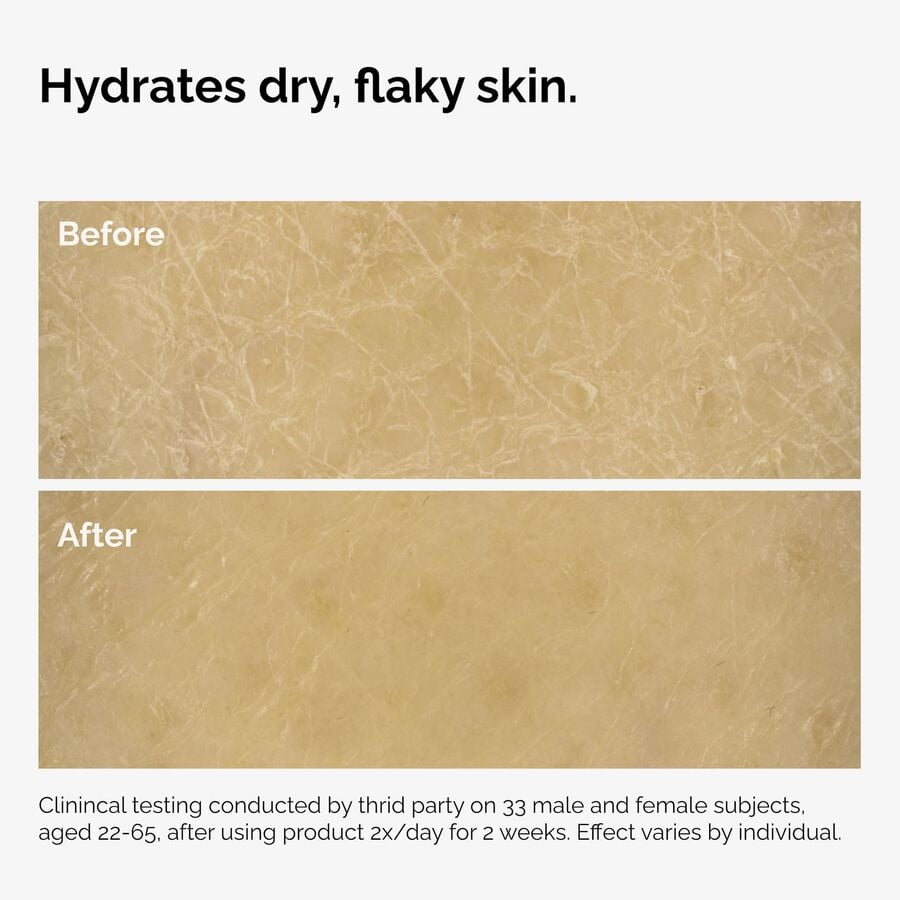 the-body-care-collection-j4 ord-natural-moisturizing-factors-inulin-body-before-after-graphic-02.jpg