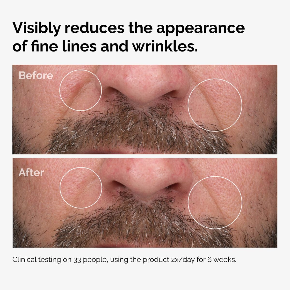 100-fermented-rose-hip-seed-oil-r9 100pct-fermented-rose-hip-before-after-wrinkles.jpg