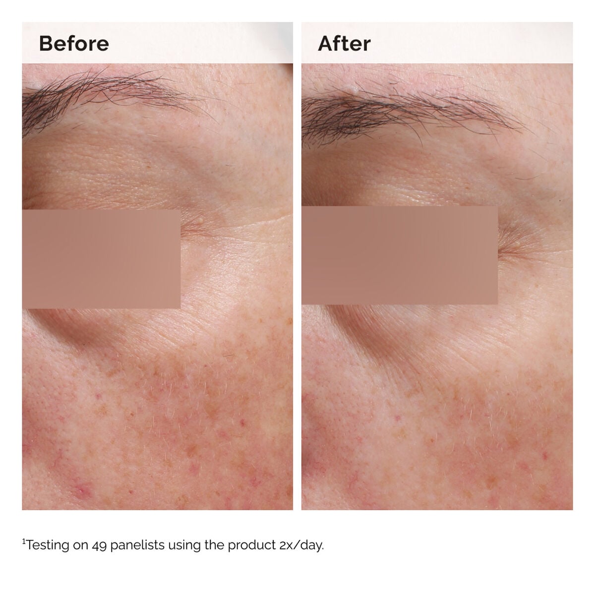 niacinamide-5-face-and-body-emulsion-k1 2024-08-23-ORD-Nia-5pct-Face-Body-B-A-Elasticity-Global-02-1x1.jpg