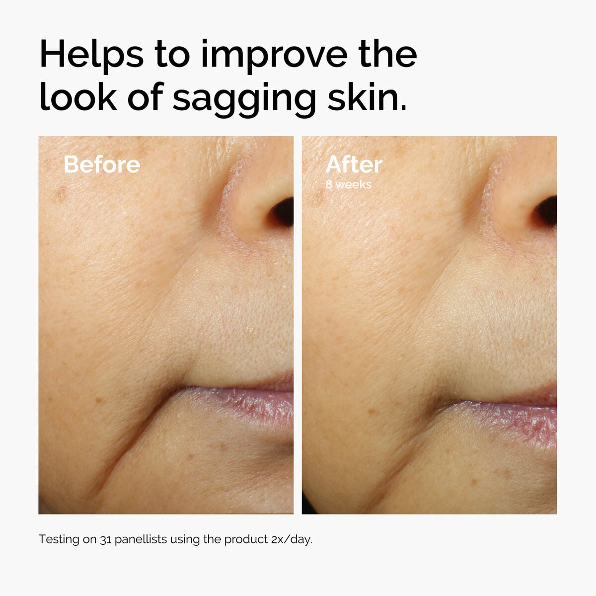 caffeine-3-escin-1-face-serum-f0 ord-caffeine-3pct-escin-1pct-face-serum-before-after-sagging.jpg
