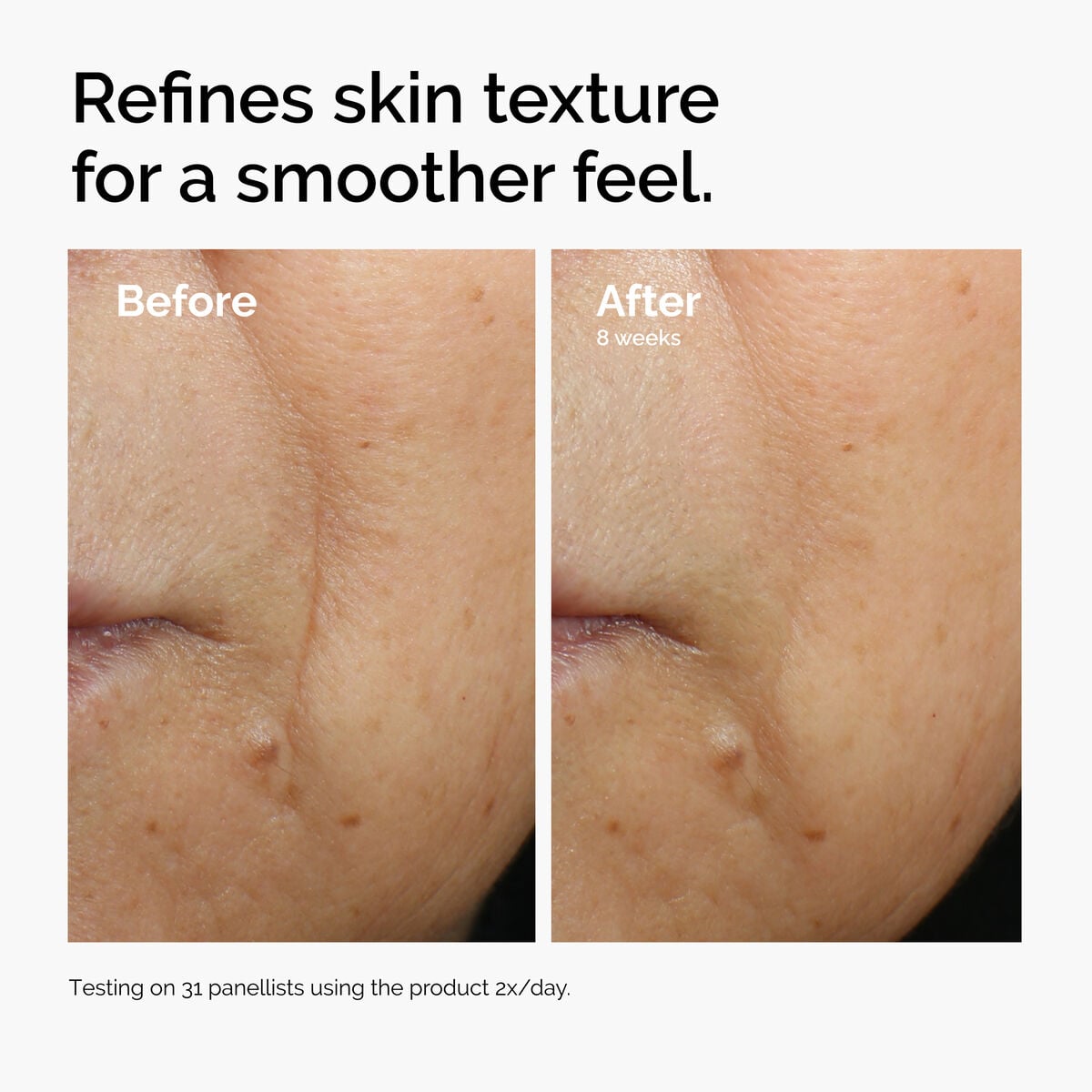 caffeine-3-escin-1-face-serum-f0 ord-caffeine-3pct-escin-1pct-face-serum-before-after-texture.jpg
