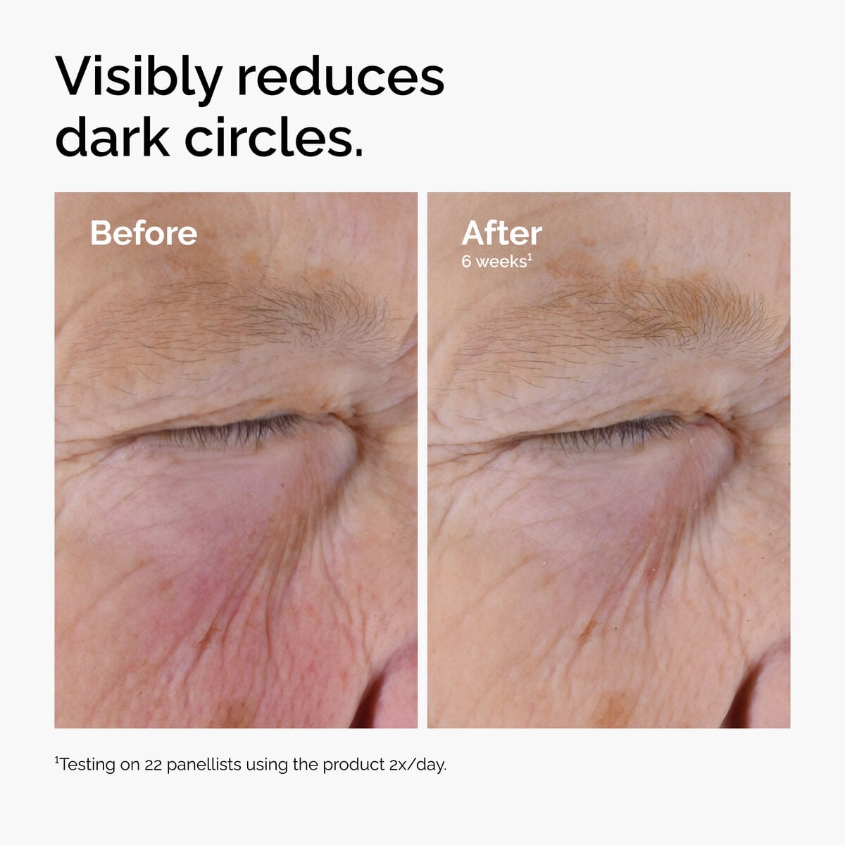 caffeine-solution-5-egcg-eye-serum-b8 ord-caffeine-solution-egcg-dark-circles-before-after.jpg