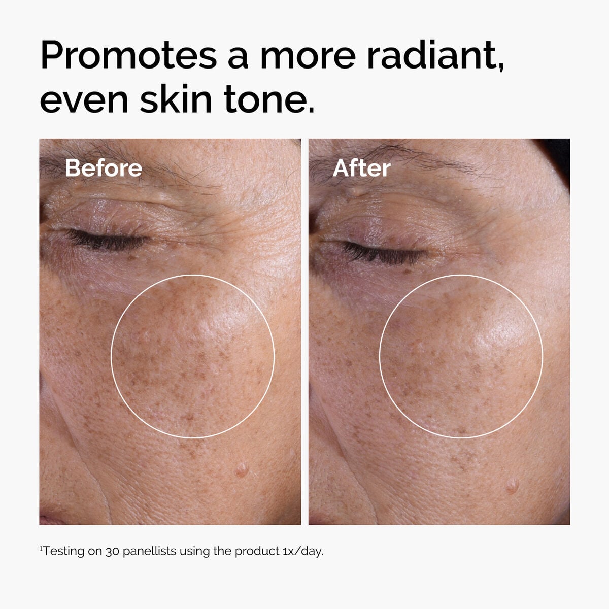 glycolic-acid-7-exfoliating-toner-l9 ord-glycolic-before-after-radiance.jpg
