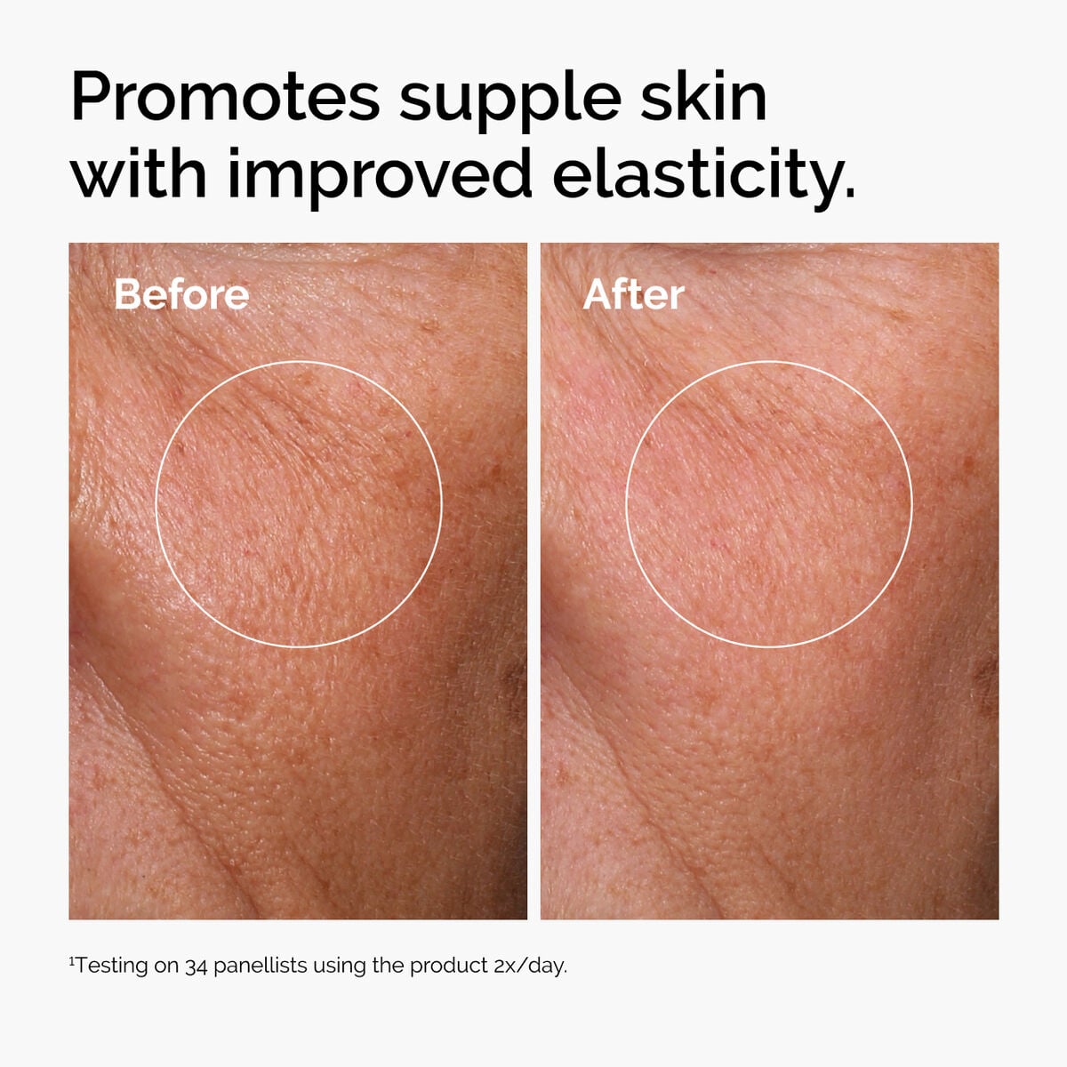 hyaluronic-acid-2-b5-with-ceramides-l0 ord-hyaluronic-acid-2pct-b5-hydrating-serum-before-after-elasticity.jpg