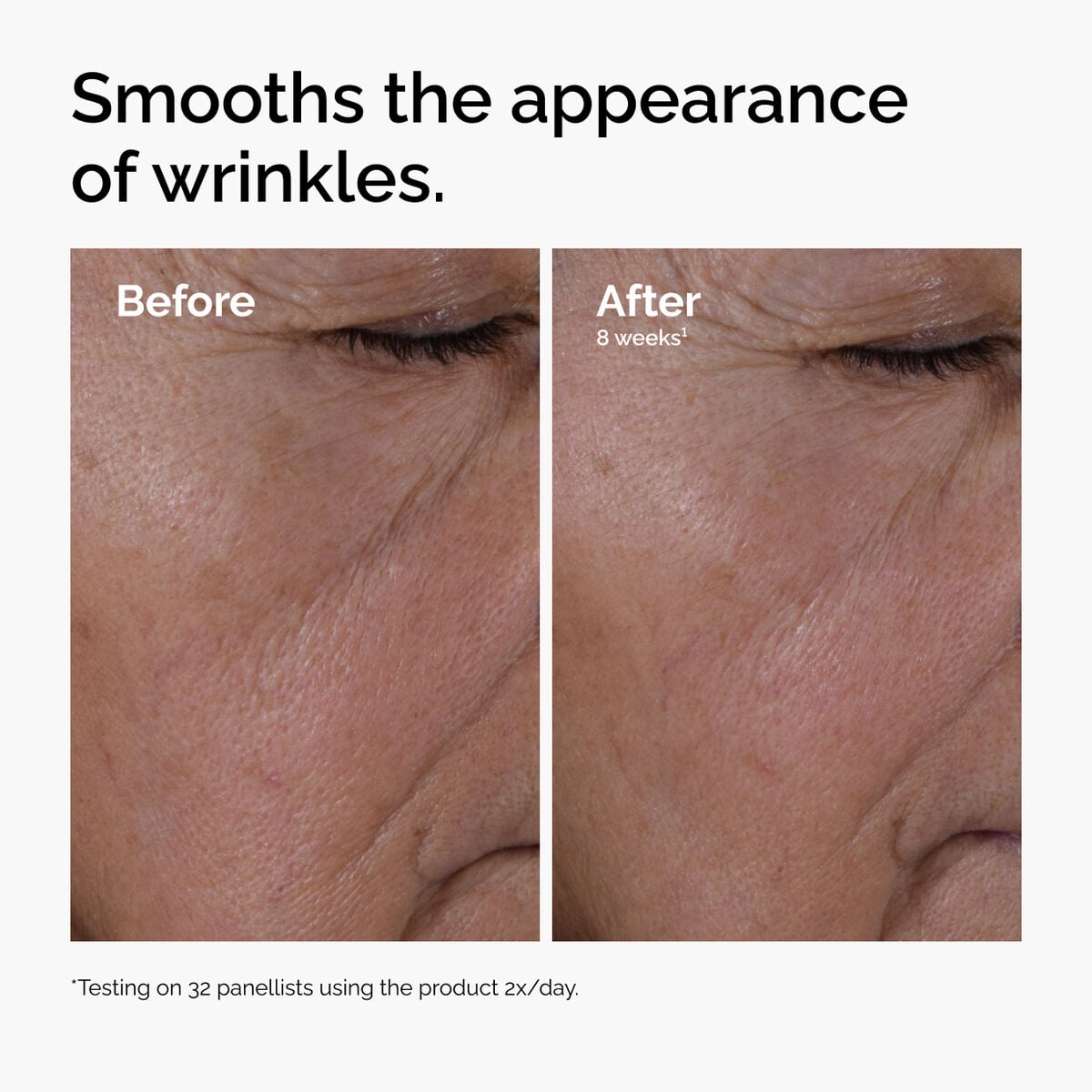 multi-peptide-ha-serum-h8 ord-multi-peptide-ha-serum-wrinkles-before-after.jpg