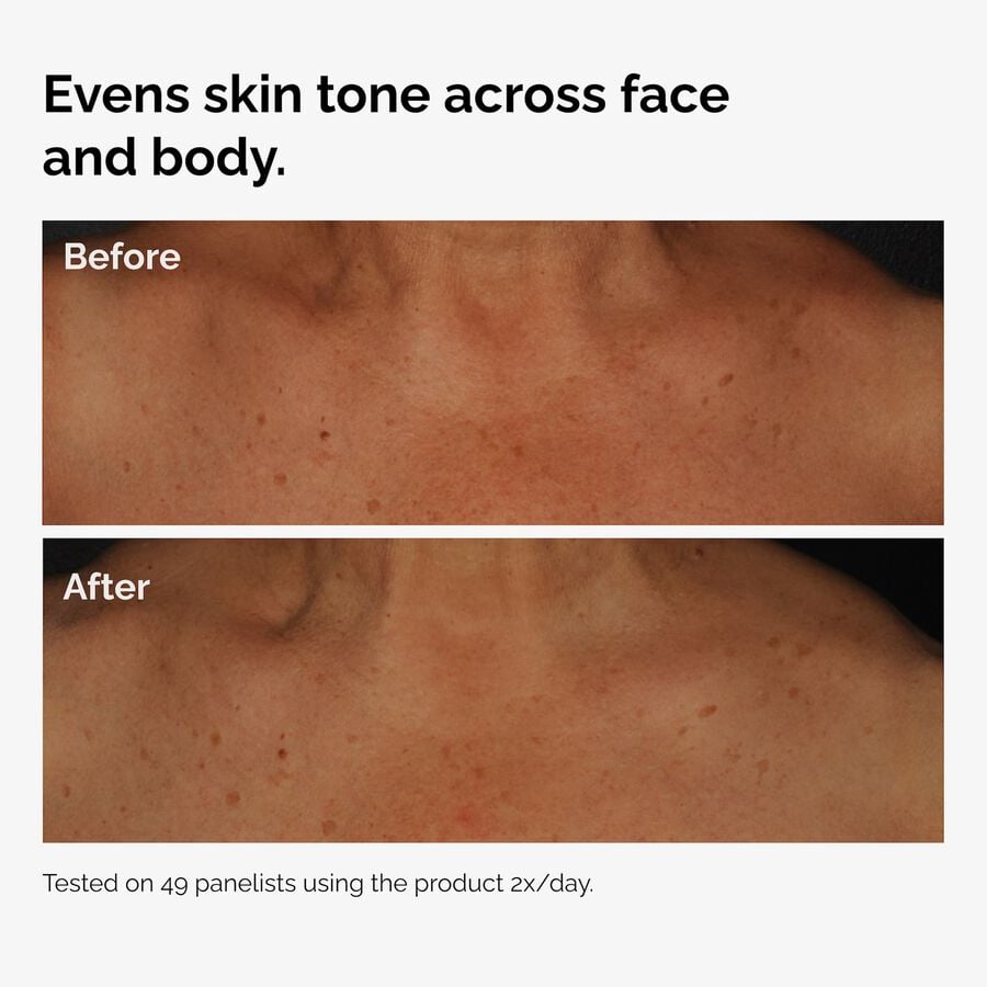 the-body-care-collection-j4 ord-niacinamide-face-body-serum-before-after-even-tone-graphic.jpg