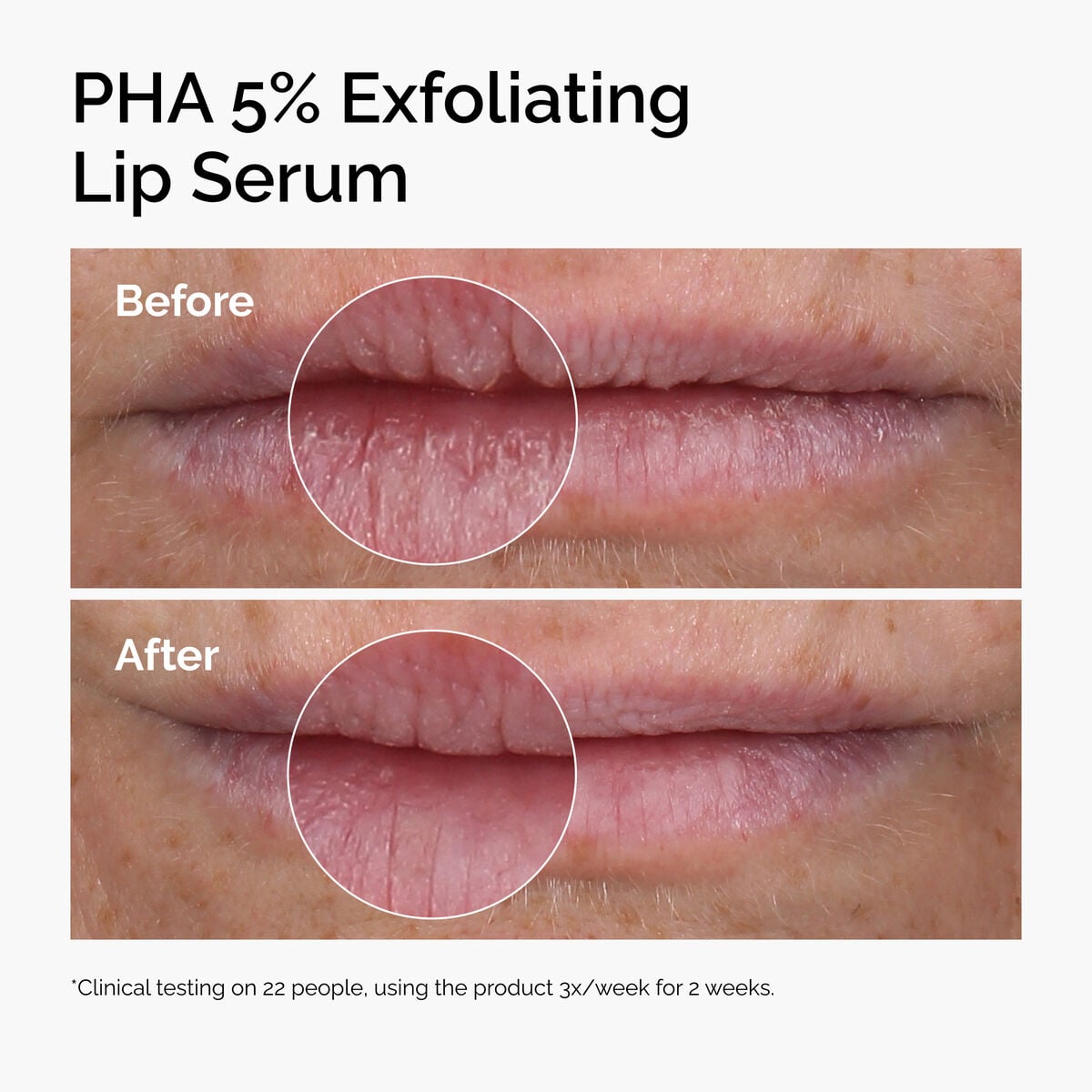 pha-5-exfoliating-lip-serum-d2 ord-pha-5pct-lip-exfoliating-serum-before-after.jpg